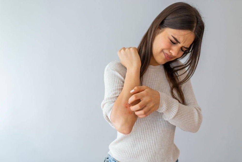 Eczema | symptoms, causes & treatment - Poko CBD